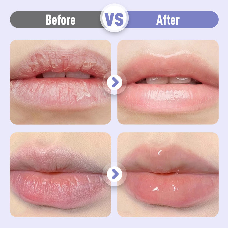 🎁LIMITED SALE💕Plumping & Anti-Wrinkle Hydrating Lip Serum