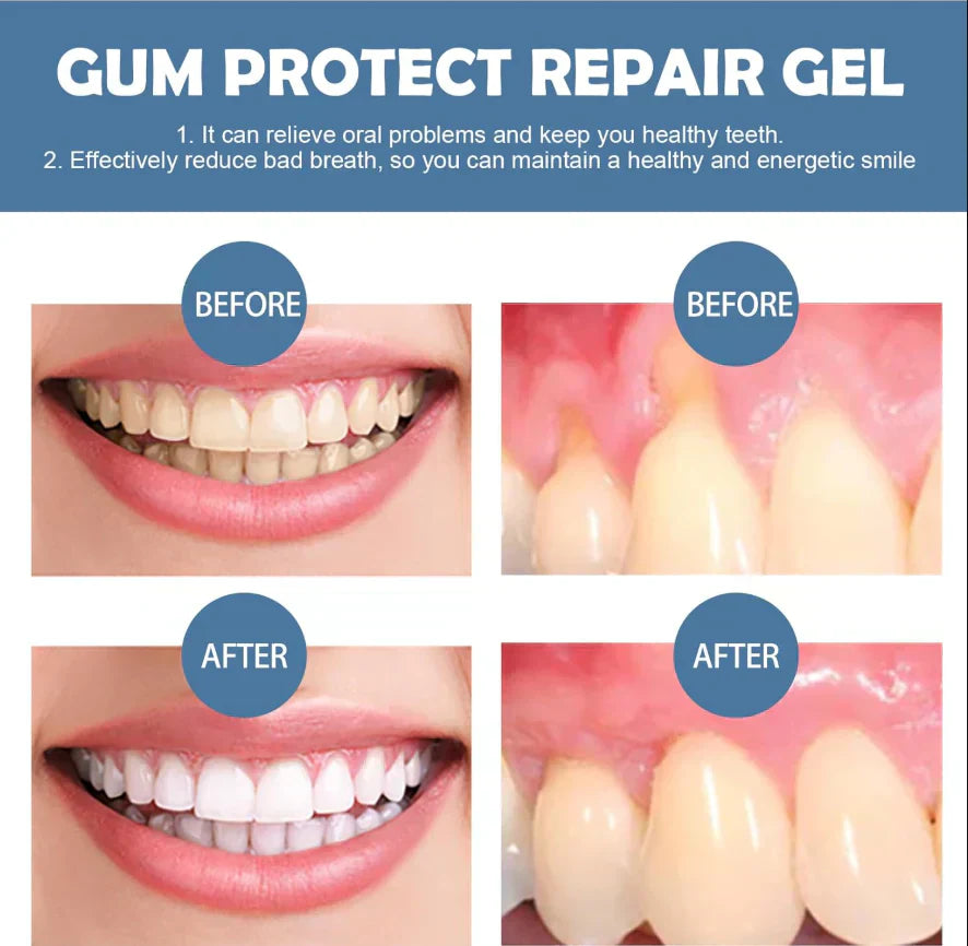 📢📢60% Off!!⏰ Teeth Whitening & Repair Gel 🦷