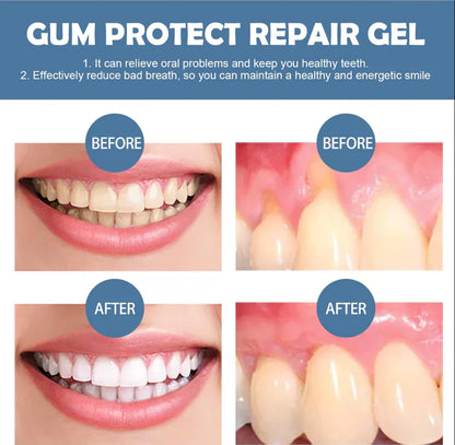 📢📢60% Off!!⏰ Teeth Whitening & Repair Gel 🦷
