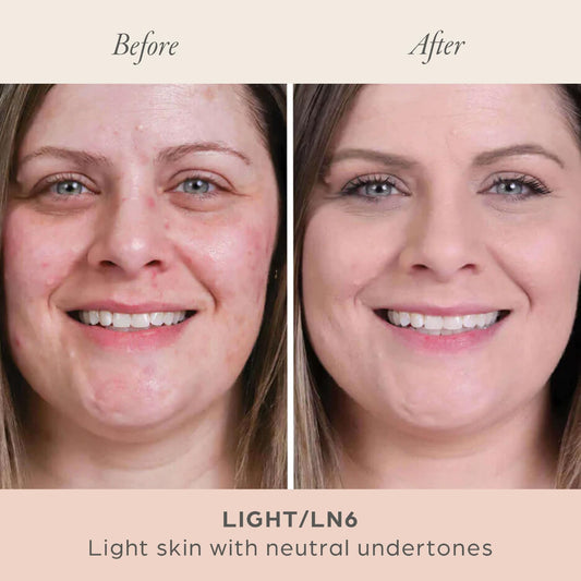 Oil-Control Mattifying Compact Powder⏳LAST DAY BUY 2 GET 1 FREE!!⚡50K+ SOLD!✨Radiance Silk Powder Foundation