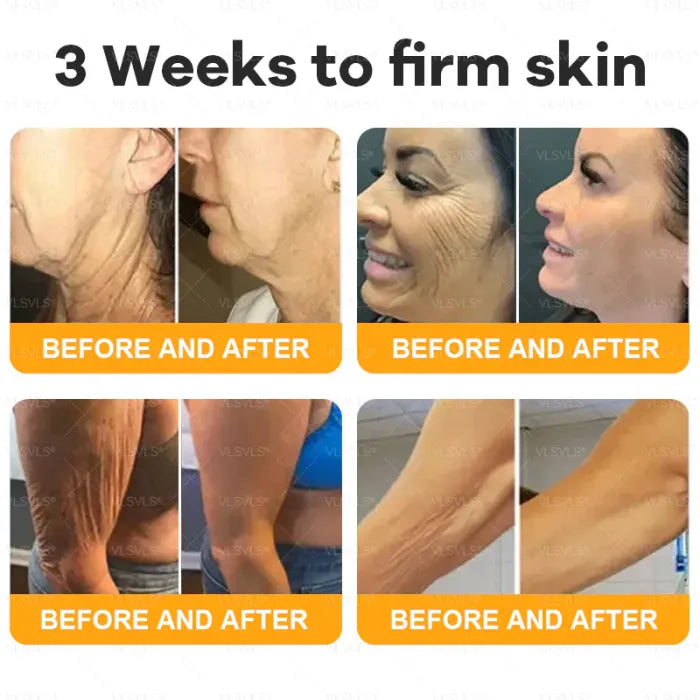 ⏰ LAST DAY 50% OFF👩‍⚕️Bee Venom Comprehensive Cream