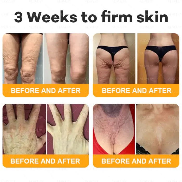 ⏰ LAST DAY 50% OFF👩‍⚕️Bee Venom Comprehensive Cream