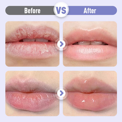 🎁LIMITED SALE💕Plumping & Anti-Wrinkle Hydrating Lip Serum