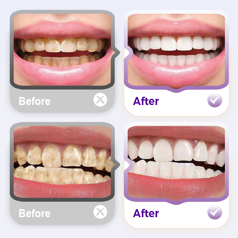 🎁 Brighten Your Teeth & Save More – Limited Deal! 🔥Lysozyme Brightening Stain-Removing Toothpaste