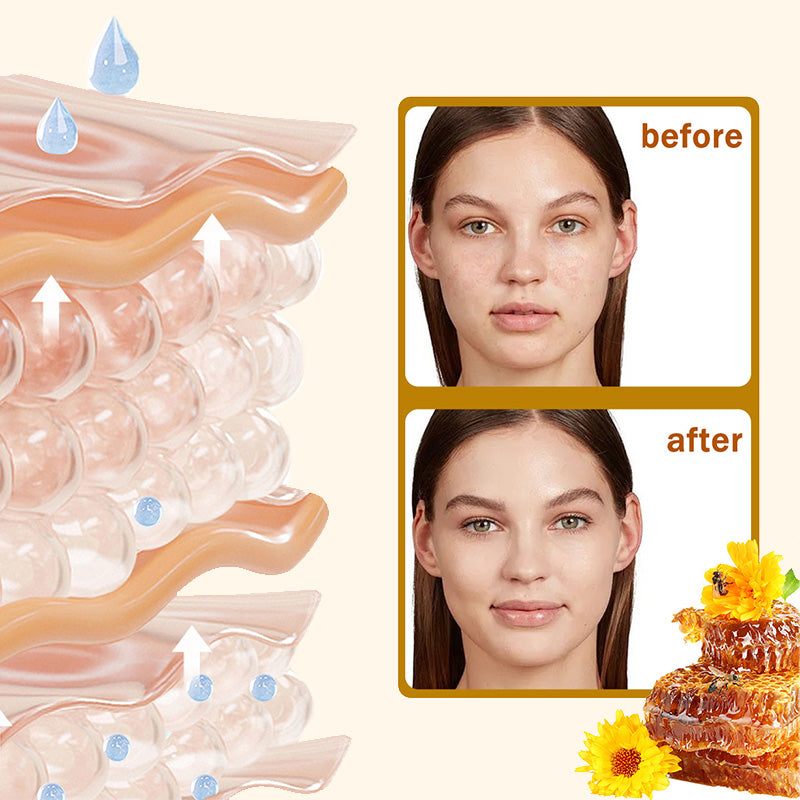 ⏰ LAST DAY 50% OFF👩‍⚕️Bee Venom Comprehensive Cream