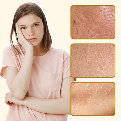 ⏰ LAST DAY 50% OFF👩‍⚕️Bee Venom Comprehensive Cream