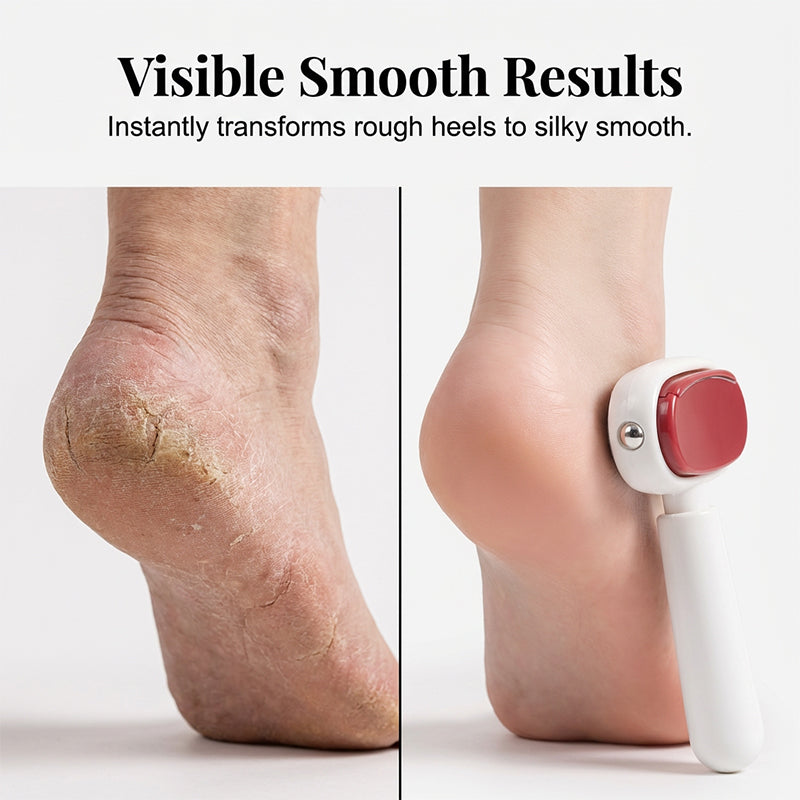 🎉Buy 2 Get 1 Free🦶 Double Sided Stainless Steel Foot Scraper Callus Remover ✨