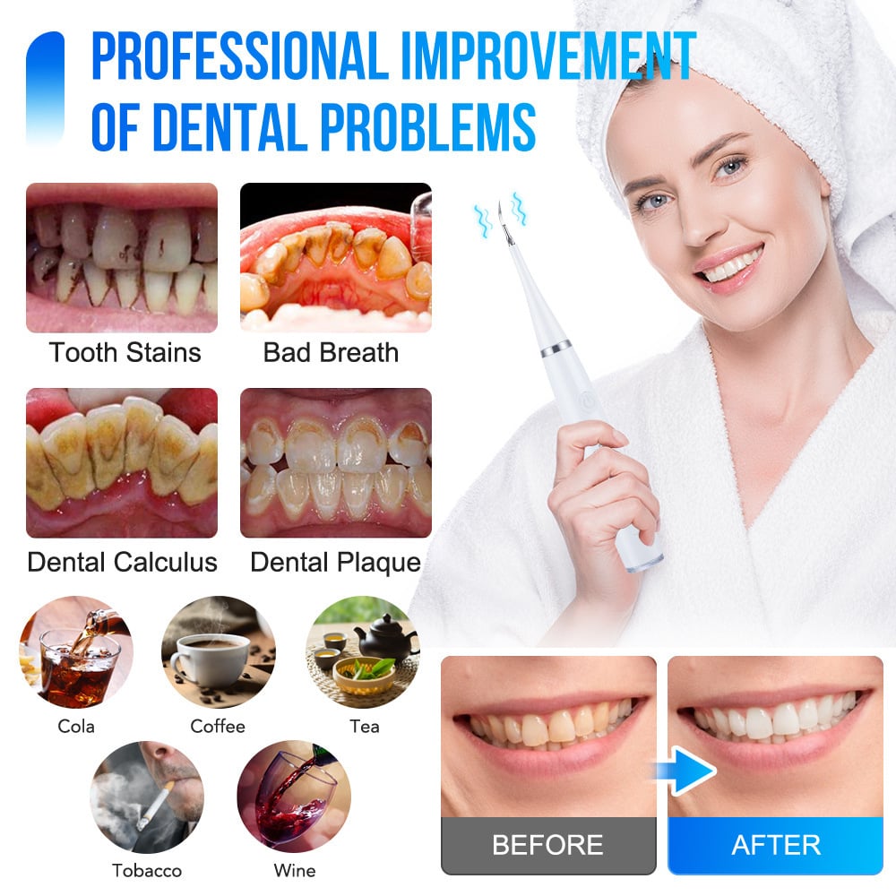 Ideal Gift - Electric Teeth Cleaner