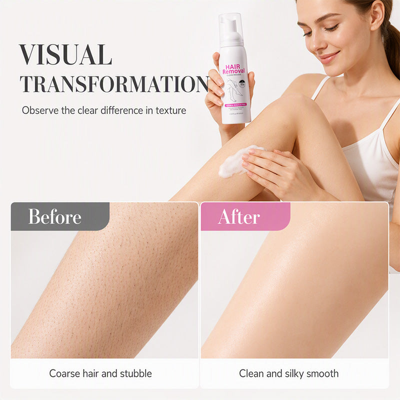 🔥Hot Sale 57% OFF🔥 Gentle Hair Removal Mousse – Helps Remove Unwanted Body Hair,  for Sensitive Skin 🧴