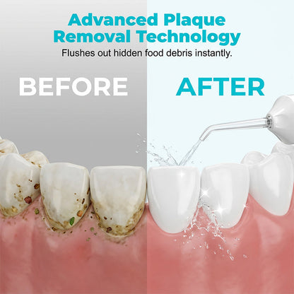 Floss Anywhere Instantly! No-Cord 230ml Water Flosser