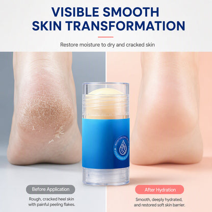 Moisturizing Petroleum Jelly Stick for Dry Hands and Feet